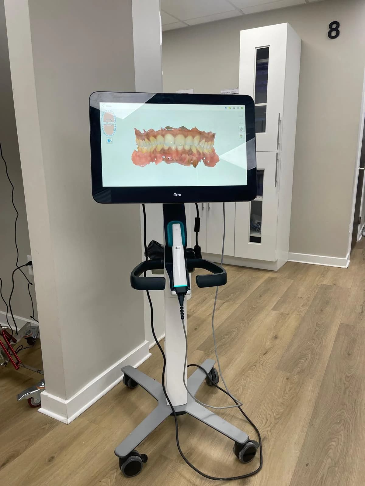 iTero Digital Scanner