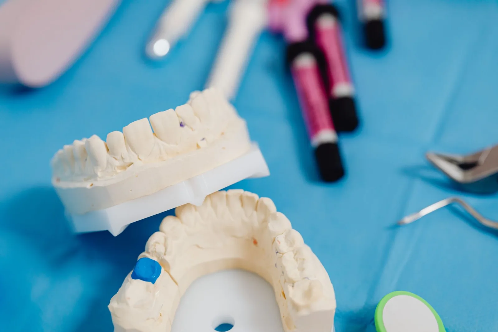 Cracked Tooth: Why It Hurts When You Let Go | Front Royal Dental Group