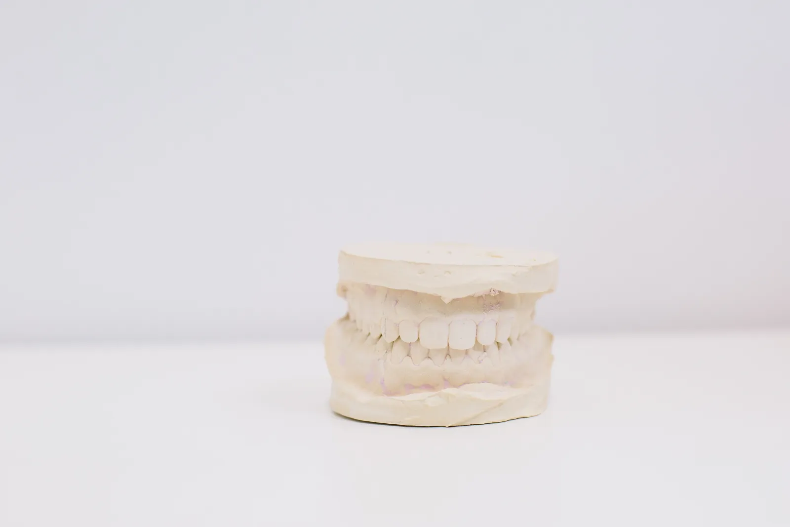 Gap or Crooked Front Tooth: Aligners, Bonding or Veneers?