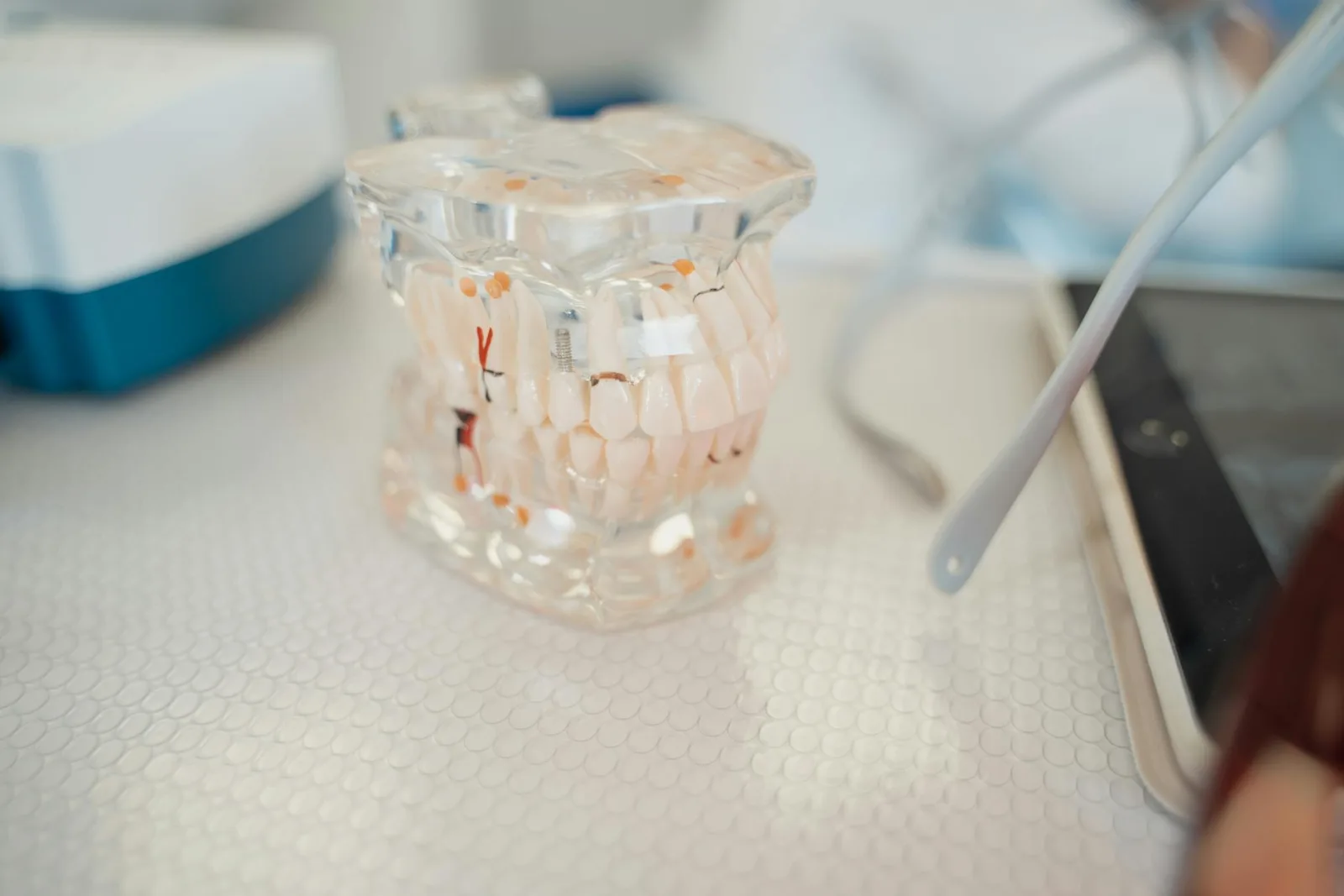 Wisdom Teeth: When They Have to Come Out | Front Royal Dental Group